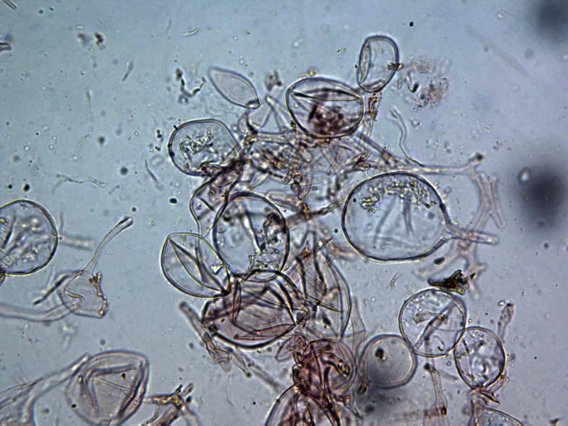 Amanita rubescens 27 - Velo general x 400